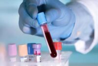 گام بزرگ سمنان برای تشخیص زودهنگام سرطان