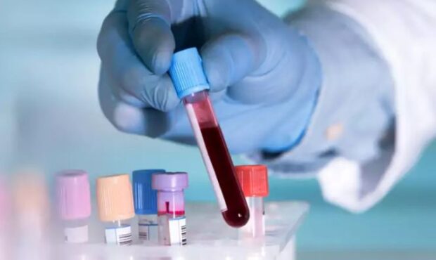 گام بزرگ سمنان برای تشخیص زودهنگام سرطان